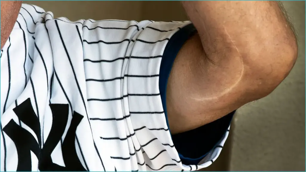Baseball at the edge: a game in crisis