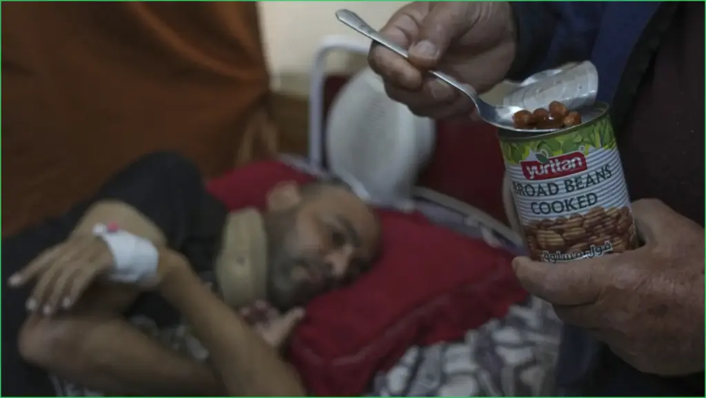 Gaza hospitals struggle to provide nutritional support for recovering patients