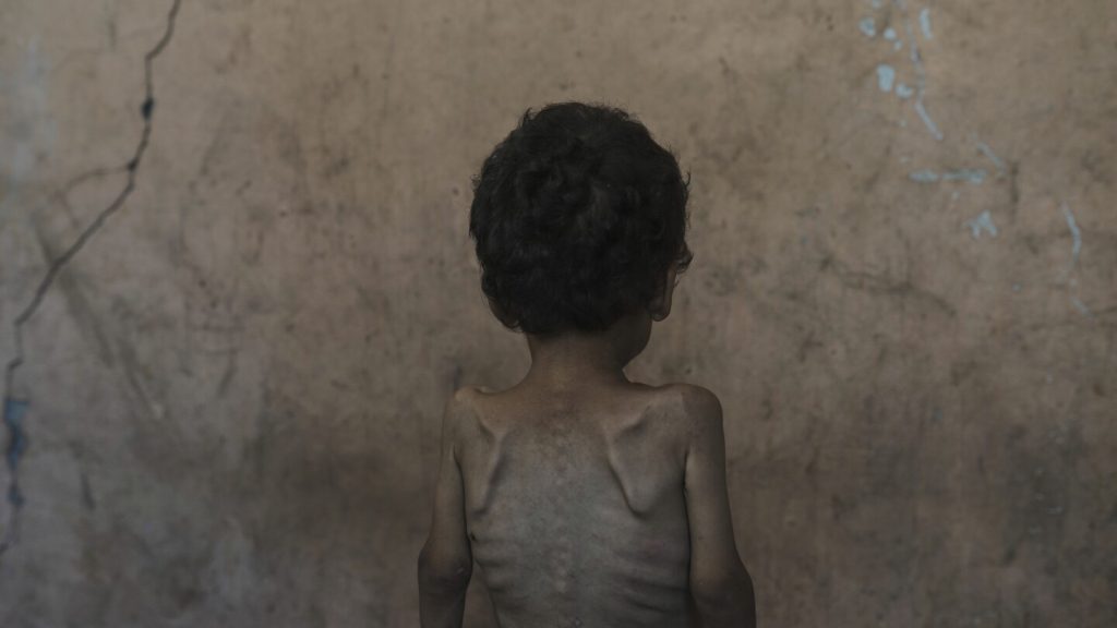 Experts warn of severe famine conditions in gaza