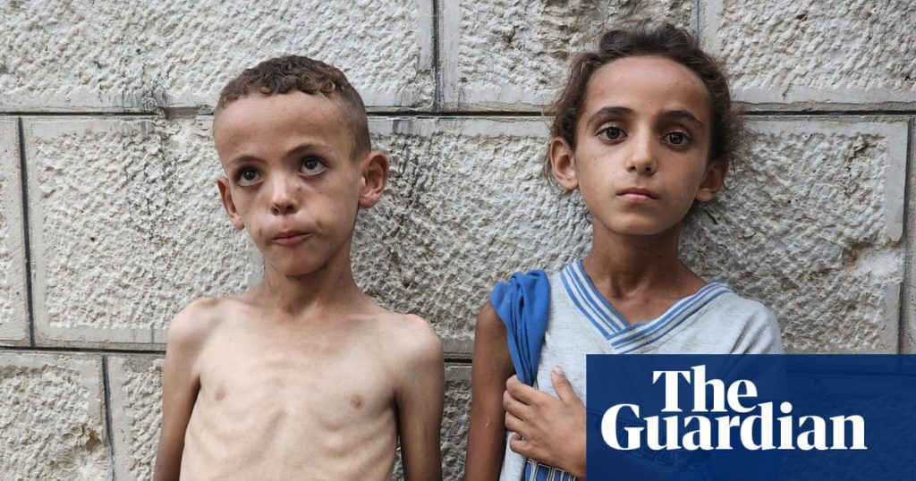 Facing unprecedented hunger: starving children overwhelm gaza hospitals