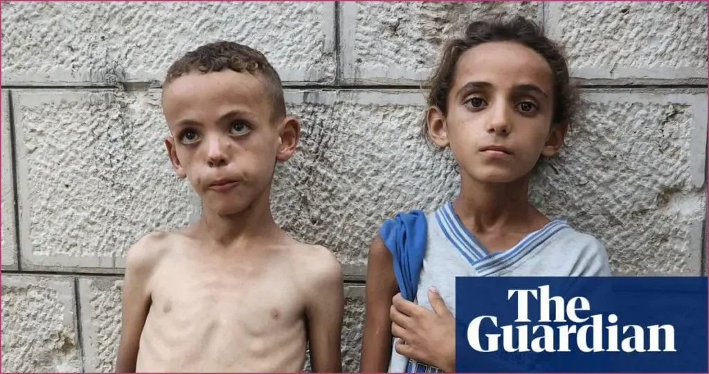 Facing Unprecedented Hunger: Starving Children Overwhelm Gaza Hospitals Facing unprecedented hunger: starving children overwhelm gaza hospitals