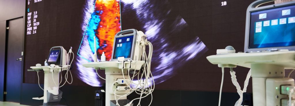 Discovering europe's promising tech stocks